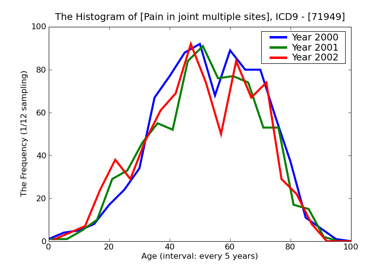 ICD9 Histogram Pain in joint multiple sites