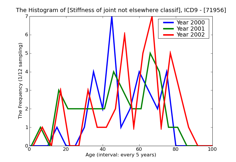 ICD9 Histogram Stiffness of joint not elsewhere classified lower leg