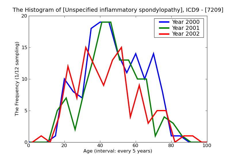 ICD9 Histogram Unspecified inflammatory spondylopathy