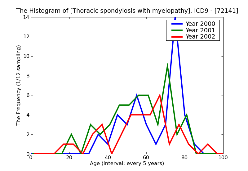 ICD9 Histogram Thoracic spondylosis with myelopathy