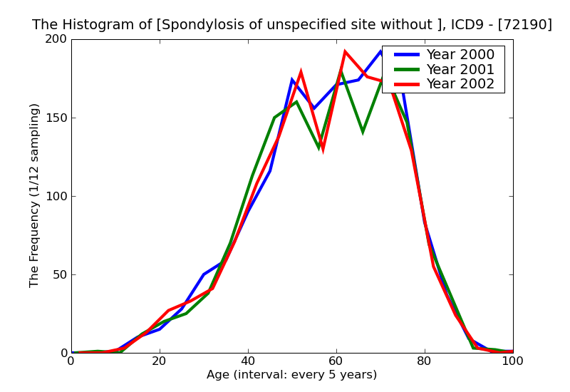 ICD9 Histogram Spondylosis of unspecified site without mention of myelopathy