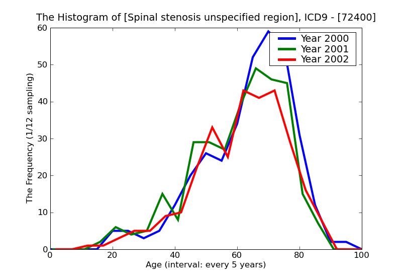 ICD9 Histogram Spinal stenosis unspecified region
