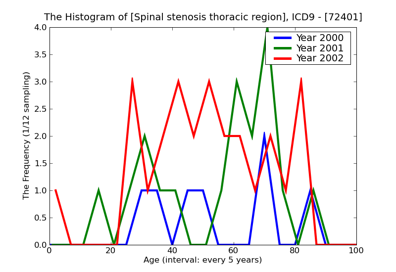 ICD9 Histogram Spinal stenosis thoracic region
