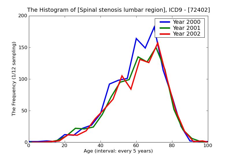 ICD9 Histogram Spinal stenosis lumbar region