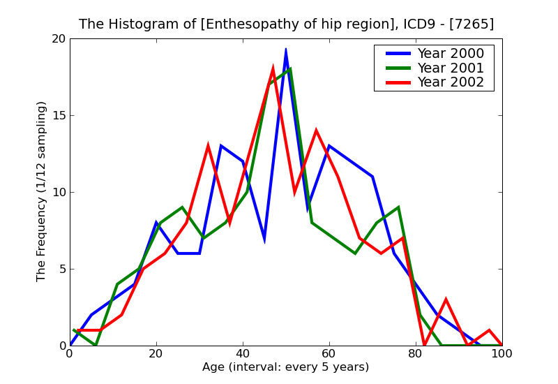 ICD9 Histogram Enthesopathy of hip region