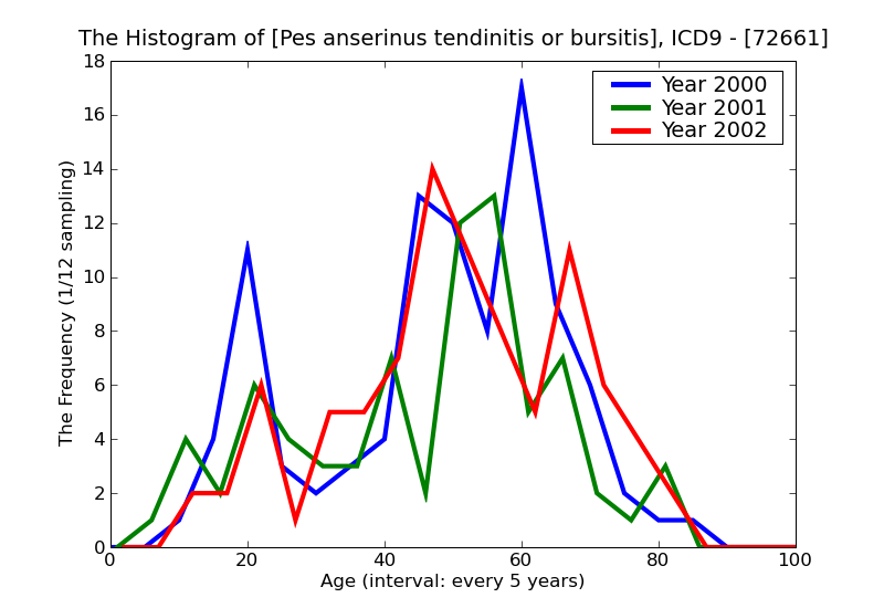 ICD9 Histogram Pes anserinus tendinitis or bursitis