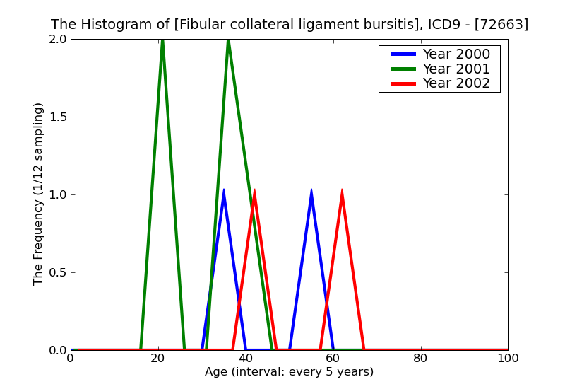 ICD9 Histogram Fibular collateral ligament bursitis