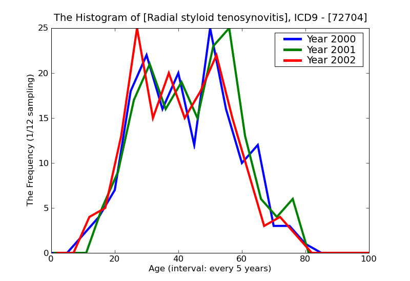 ICD9 Histogram Radial styloid tenosynovitis