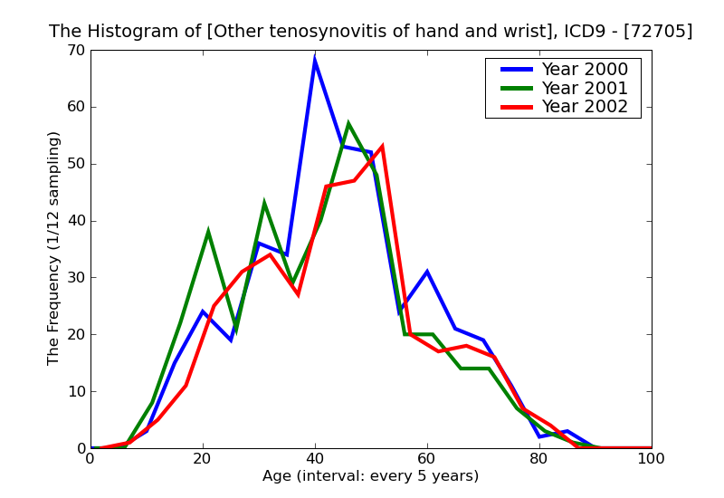 ICD9 Histogram Other tenosynovitis of hand and wrist