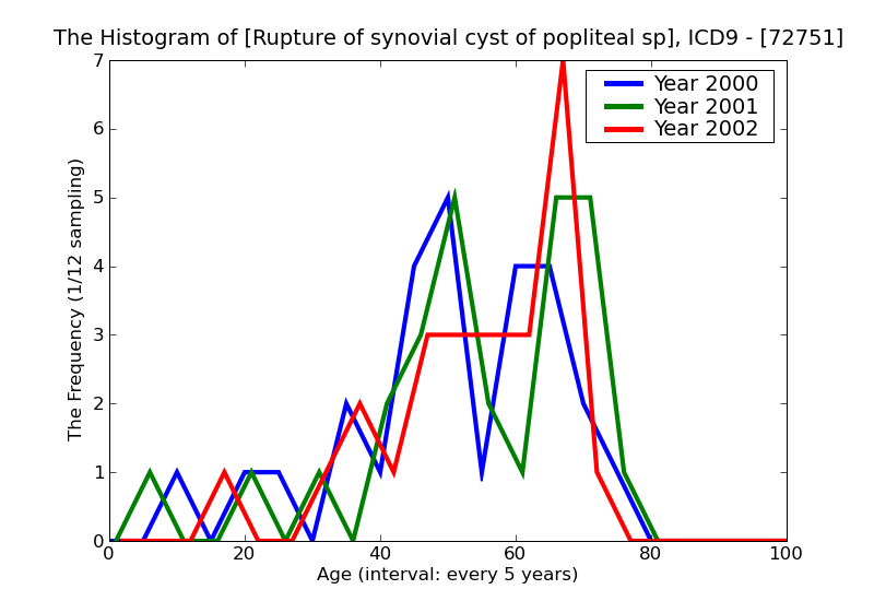 ICD9 Histogram Rupture of synovial cyst of popliteal space