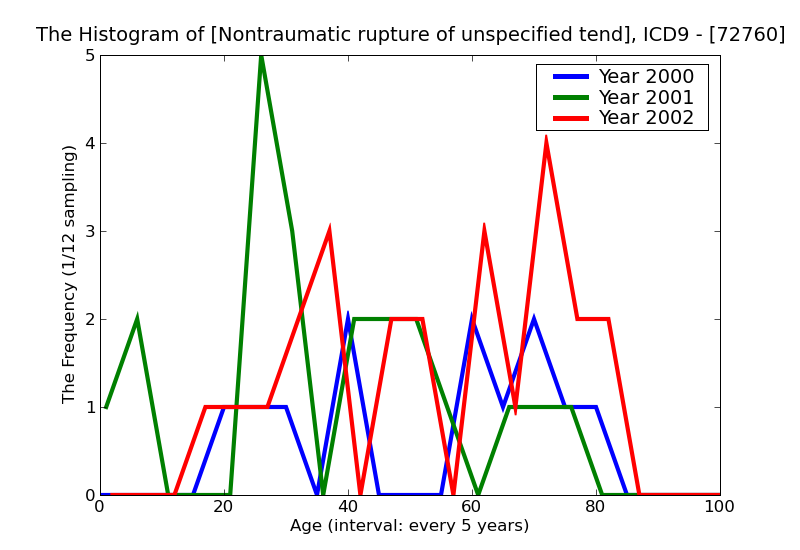 ICD9 Histogram Nontraumatic rupture of unspecified tendon