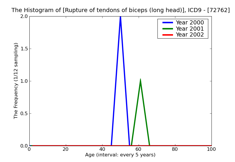 ICD9 Histogram Rupture of tendons of biceps (long head)