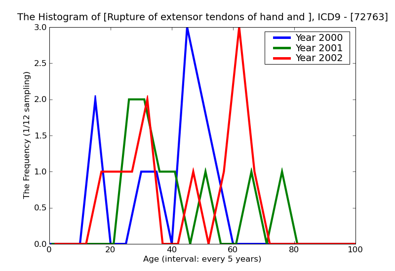 ICD9 Histogram Rupture of extensor tendons of hand and wrist