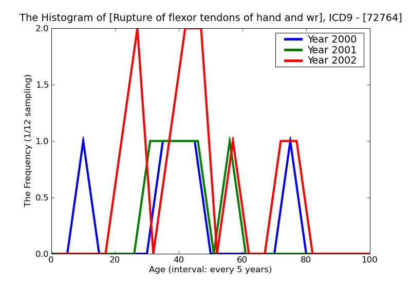 ICD9 Histogram Rupture of flexor tendons of hand and wrist