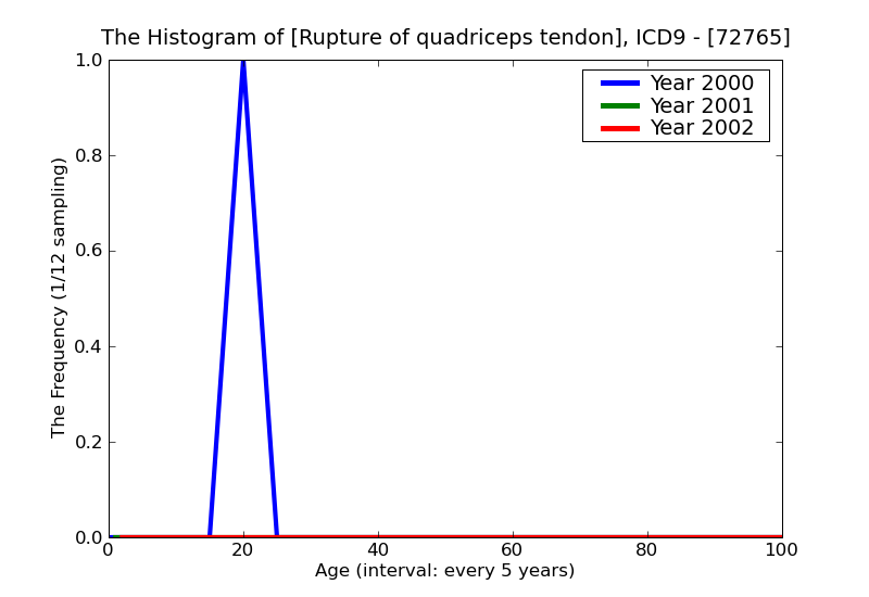 ICD9 Histogram Rupture of quadriceps tendon