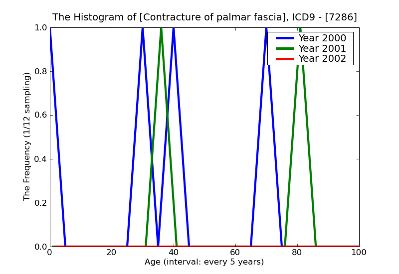 ICD9 Histogram Contracture of palmar fascia