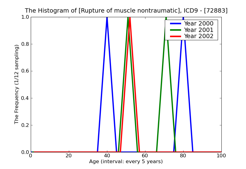 ICD9 Histogram Rupture of muscle nontraumatic