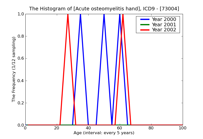 ICD9 Histogram Acute osteomyelitis hand