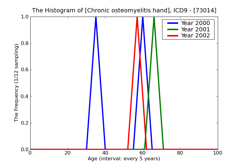 ICD9 Histogram Chronic osteomyelitis hand
