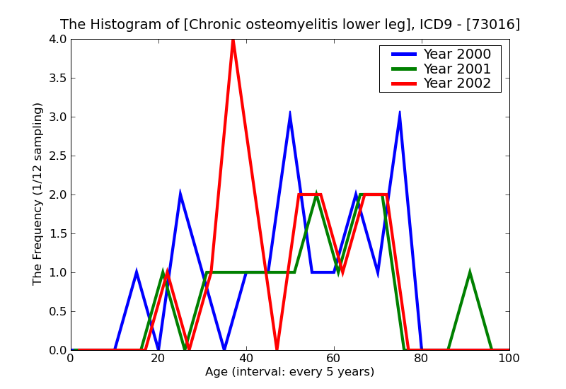 ICD9 Histogram Chronic osteomyelitis lower leg