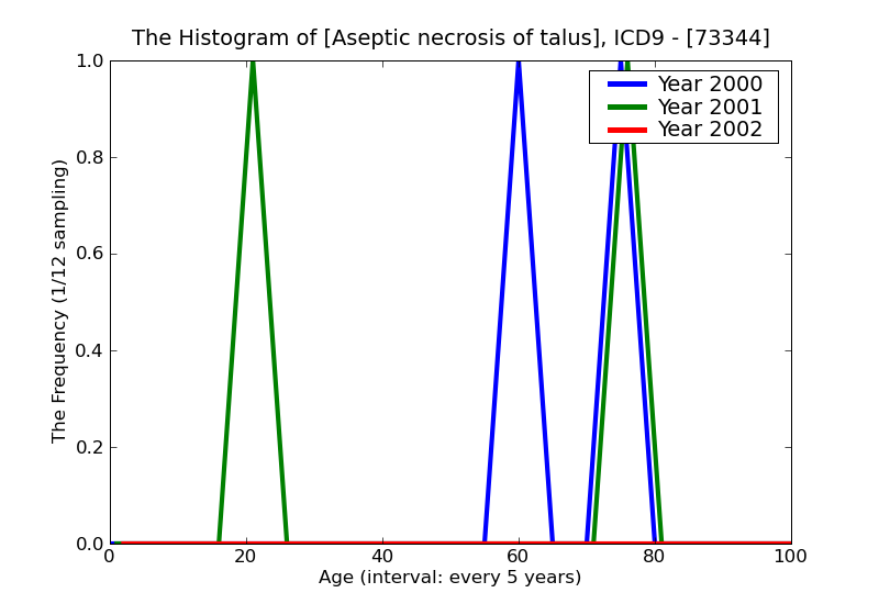ICD9 Histogram Aseptic necrosis of talus
