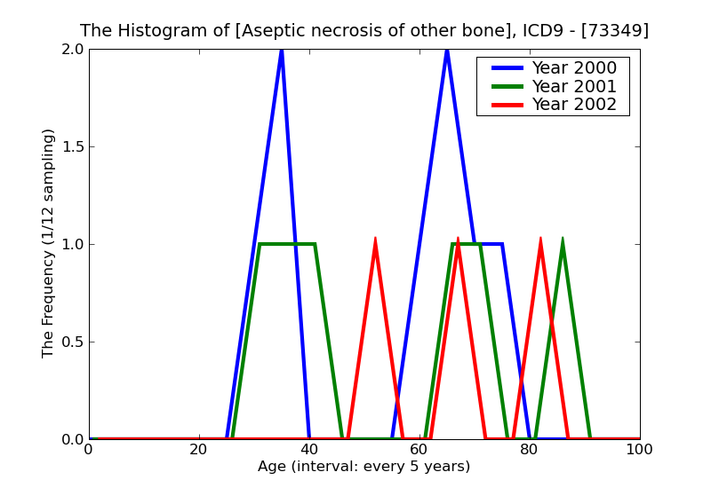 ICD9 Histogram Aseptic necrosis of other bone