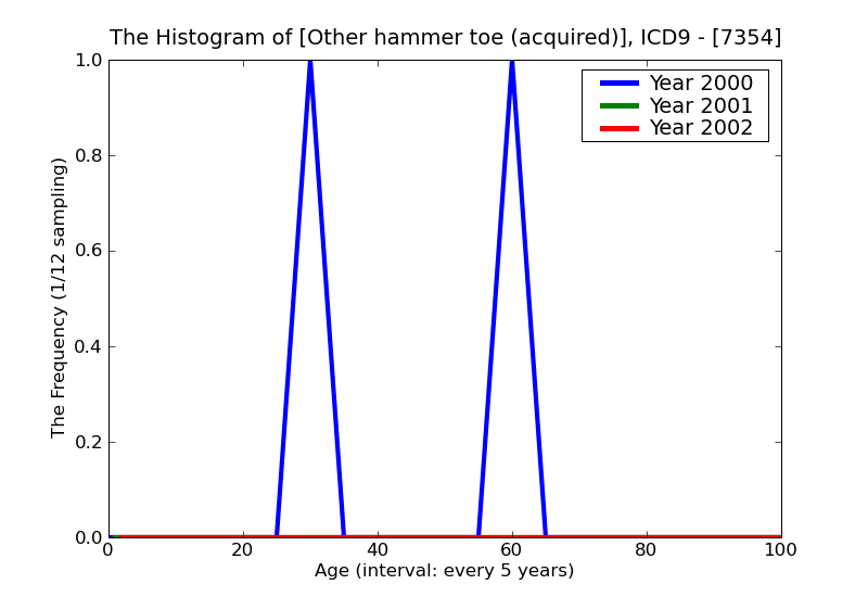 ICD9 Histogram Other hammer toe (acquired)