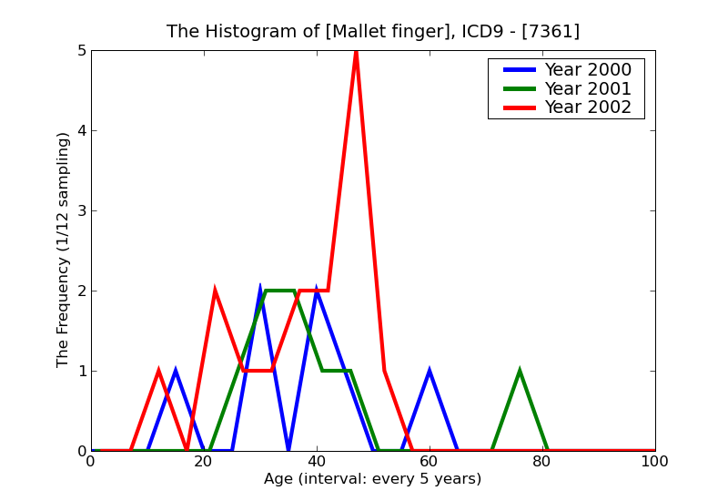 ICD9 Histogram Mallet finger
