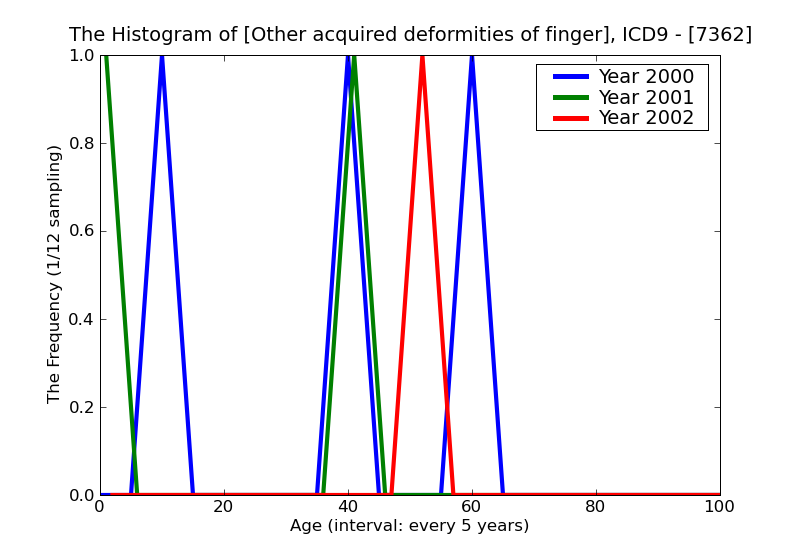 ICD9 Histogram Other acquired deformities of finger