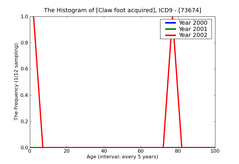 ICD9 Histogram Claw foot acquired