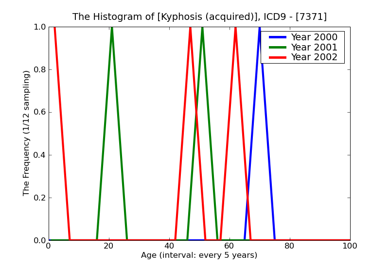 ICD9 Histogram Kyphosis (acquired)
