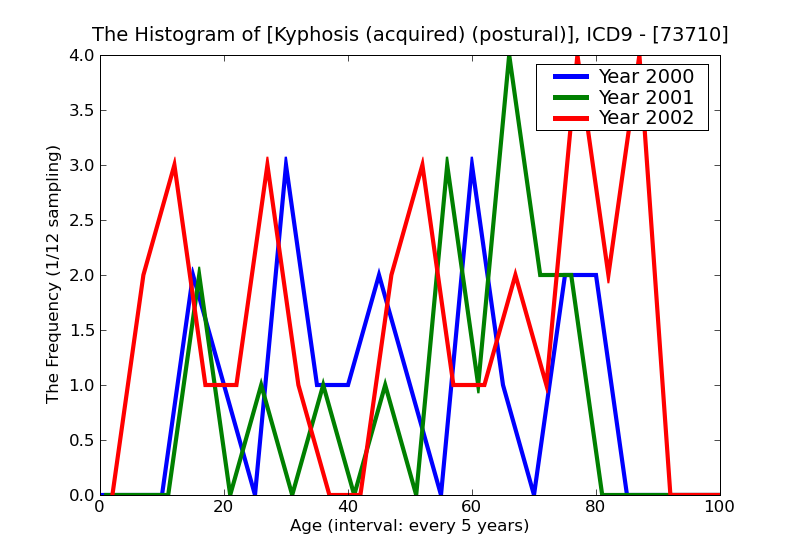 ICD9 Histogram Kyphosis (acquired) (postural)