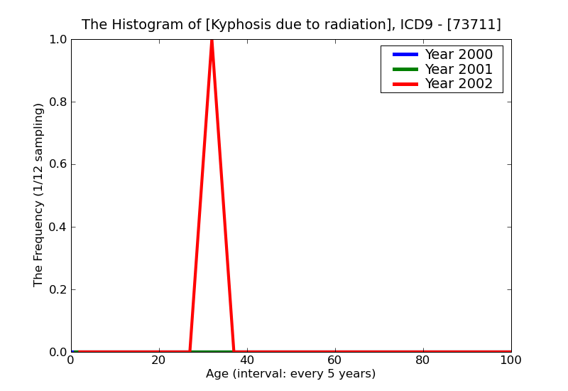 ICD9 Histogram Kyphosis due to radiation