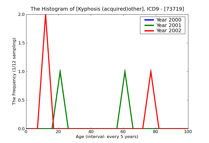 ICD9 Histogram Kyphosis (acquired)other
