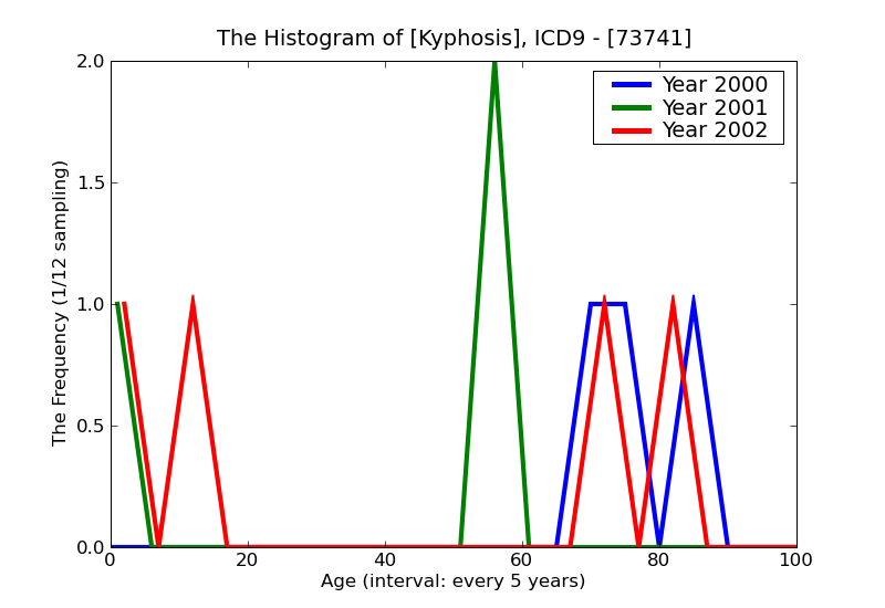 ICD9 Histogram Kyphosis