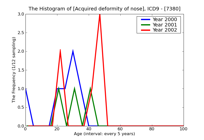 ICD9 Histogram Acquired deformity of nose