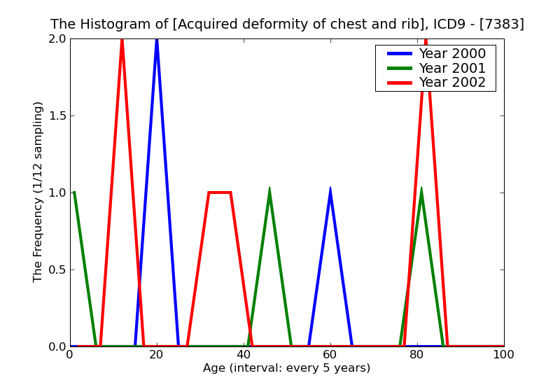 ICD9 Histogram Acquired deformity of chest and rib