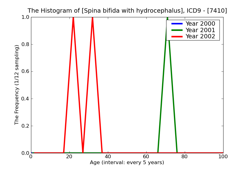 ICD9 Histogram Spina bifida with hydrocephalus
