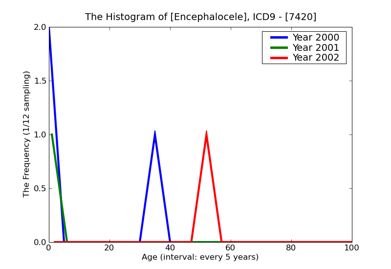 ICD9 Histogram Encephalocele