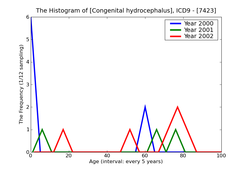 ICD9 Histogram Congenital hydrocephalus