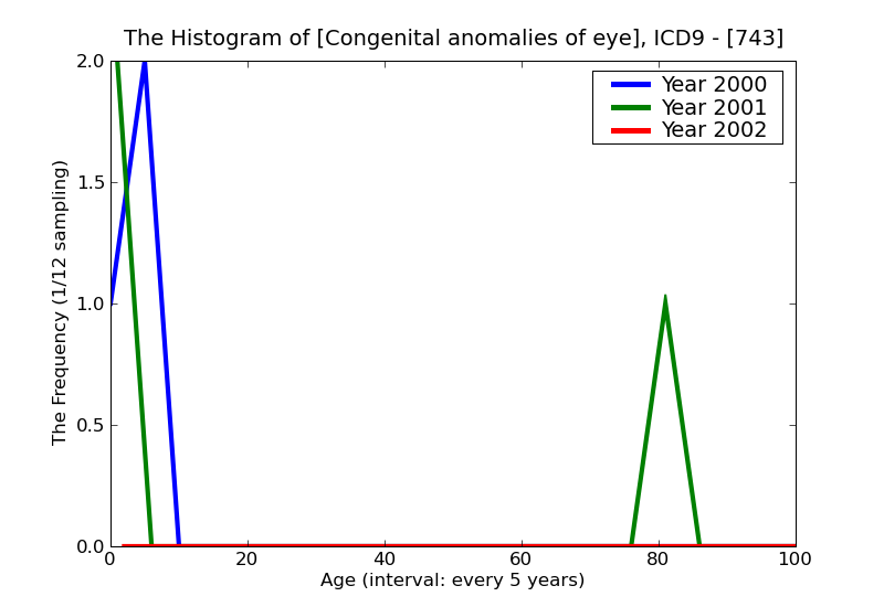 ICD9 Histogram Congenital anomalies of eye