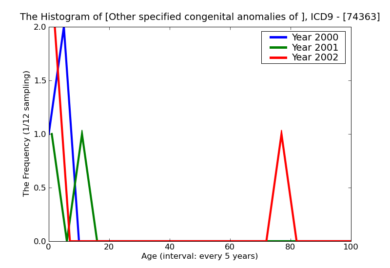 ICD9 Histogram Other specified congenital anomalies of eyelid