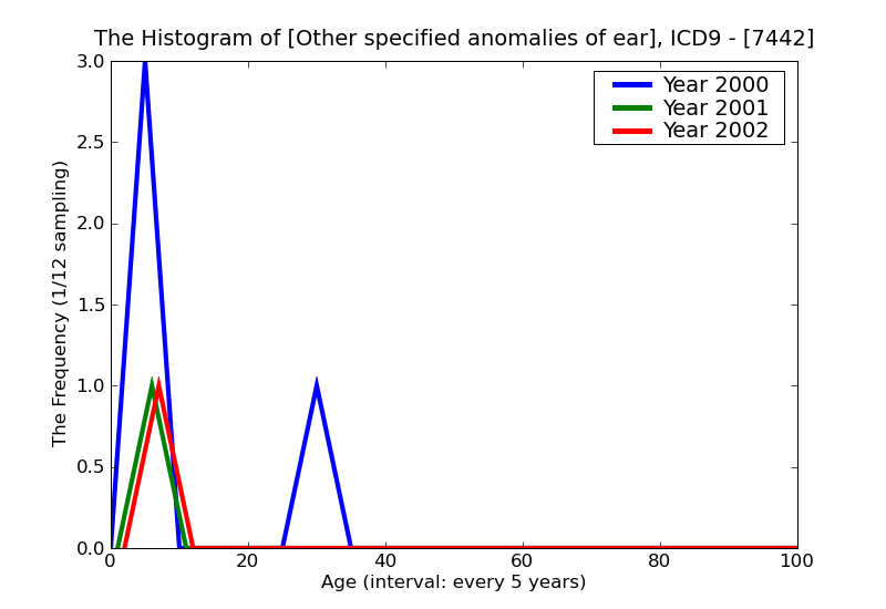 ICD9 Histogram Other specified anomalies of ear