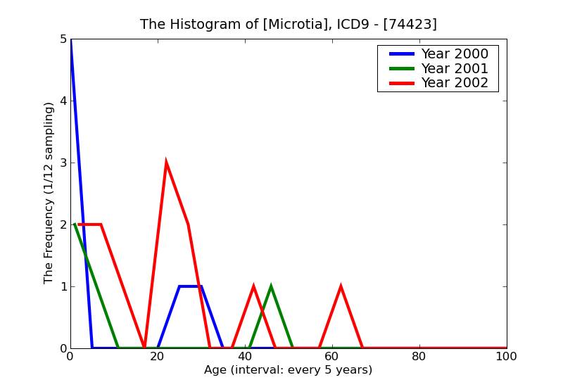 ICD9 Histogram Microtia