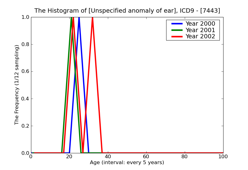 ICD9 Histogram Unspecified anomaly of ear
