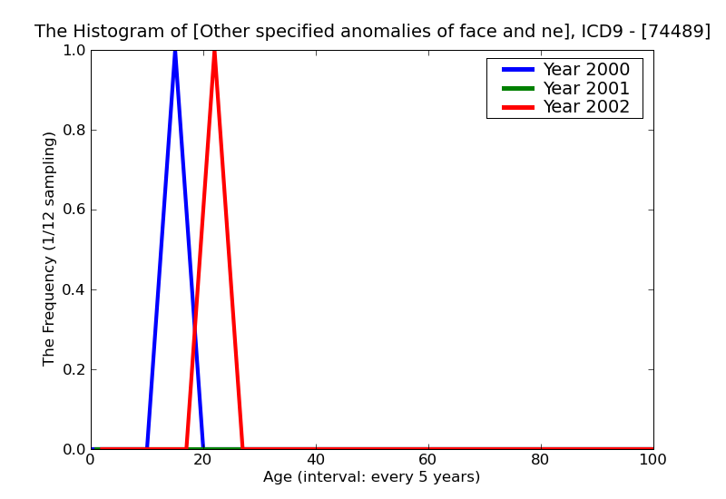 ICD9 Histogram Other specified anomalies of face and neck