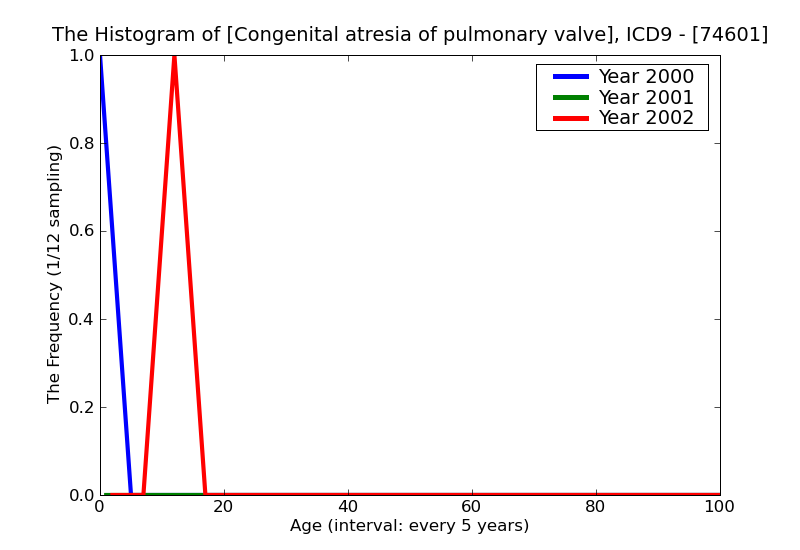 ICD9 Histogram Congenital atresia of pulmonary valve