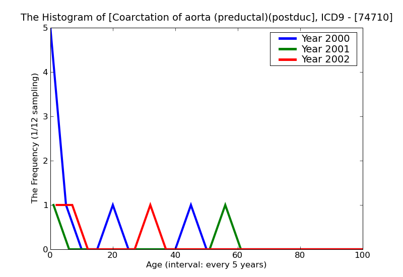ICD9 Histogram Coarctation of aorta (preductal)(postductal)