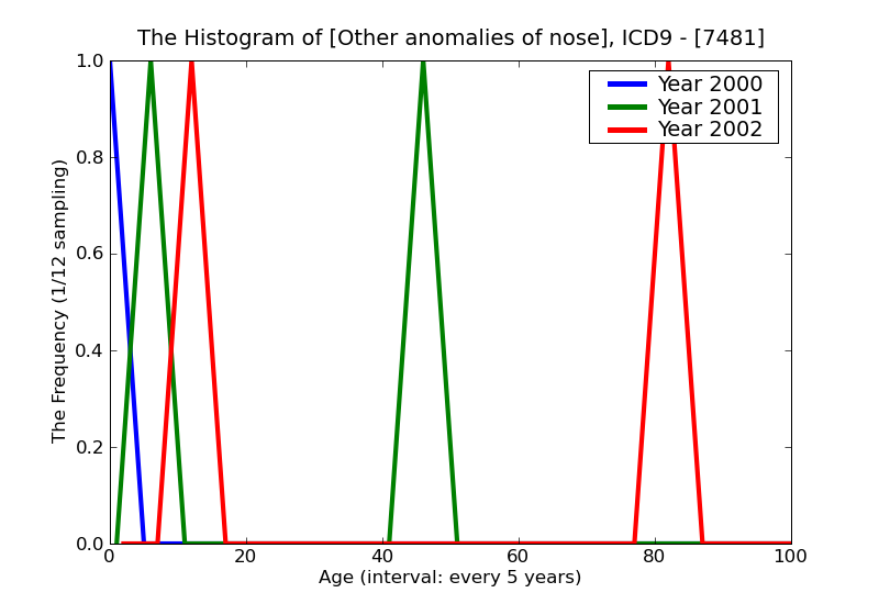 ICD9 Histogram Other anomalies of nose