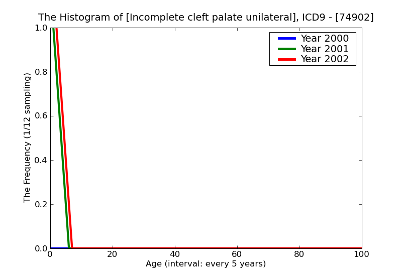 ICD9 Histogram Incomplete cleft palate unilateral